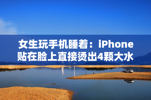 女生玩手机睡着：iPhone贴在脸上直接烫出4颗大水泡！