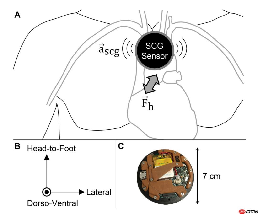 创新医疗新参数-SCG（心震图）：详细解读版