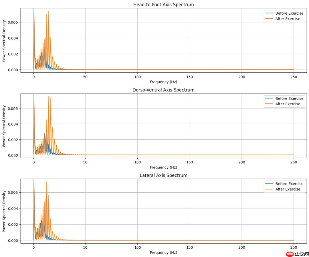 创新医疗新参数-SCG（心震图）：详细解读版