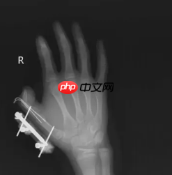 网购收到这东西 千万当心!会爆炸、会“放毒”