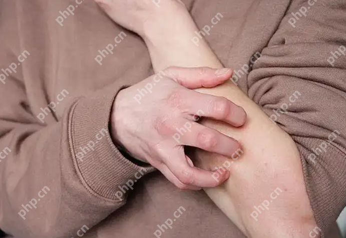 秋季过敏高发,医生提醒:切莫忽视“小”症状 - php中文网