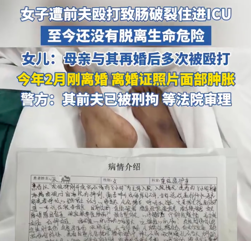 女子遭前夫殴打致肠破裂住进ICU 警方:嫌疑人已被刑拘 - php中文网